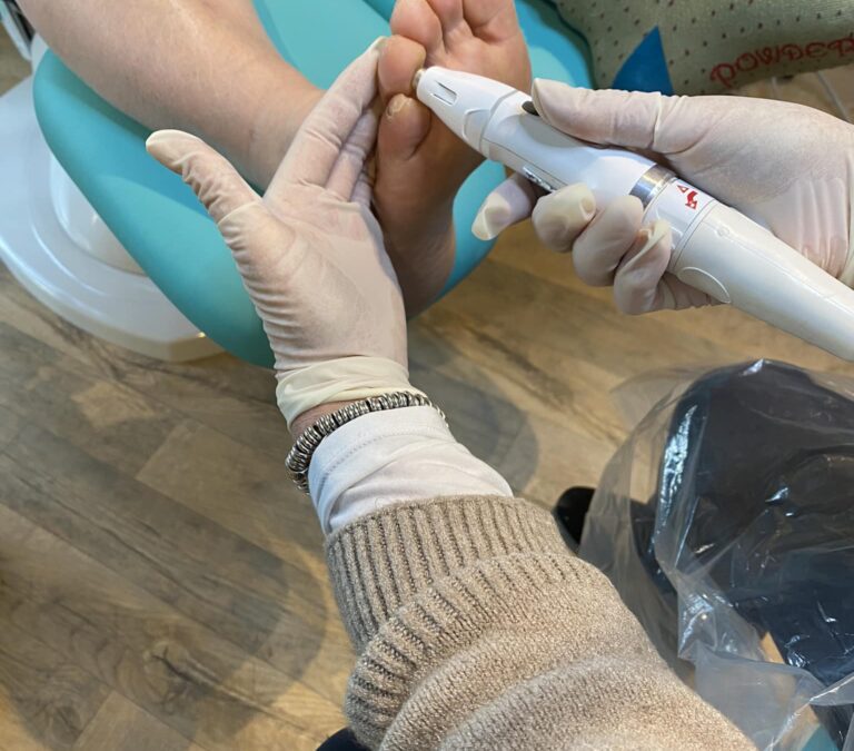 OFFER: Verrucae problem? 50% off Microwave Therapy, only available on the 27th of March!